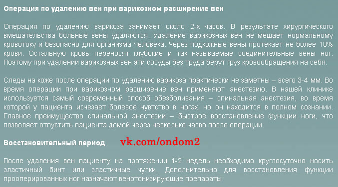 Статья про удаление варикозных вен.